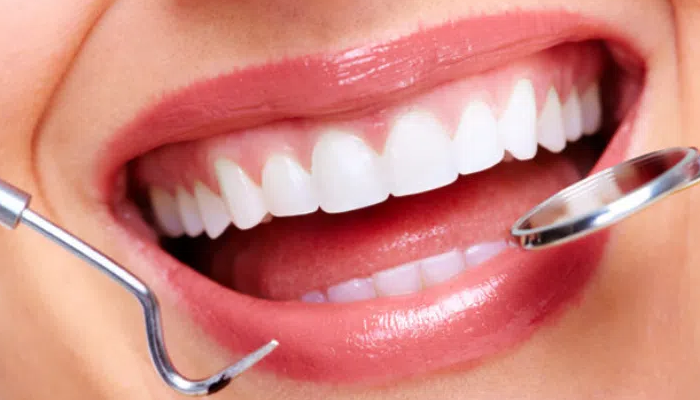 Unlocking Your Perfect Smile: The Power of Dental Veneers